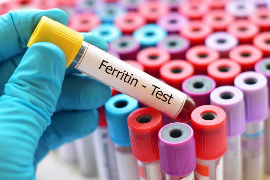Ferritin-Test